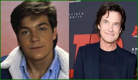 Jason Bateman Plastic Surgery Before and After