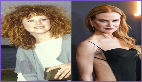 Nicole Kidman's 