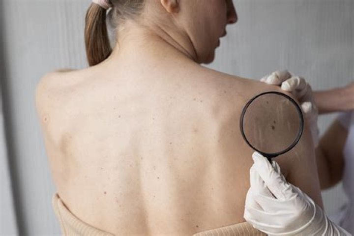 Are liposarcomas hard or soft?