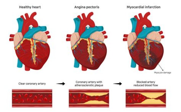 Can a heart condition cause a seizure?
