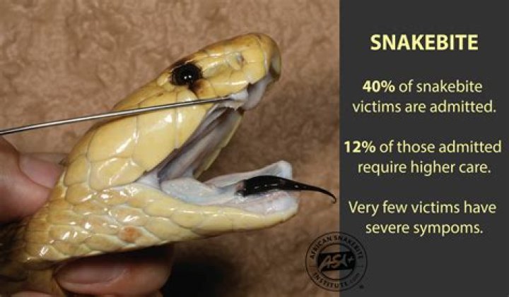 Can a snake bite you after it's dead?