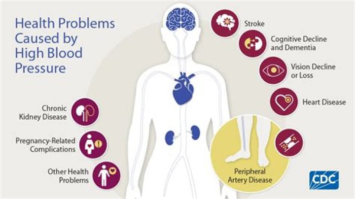 Can bupropion cause high blood pressure?