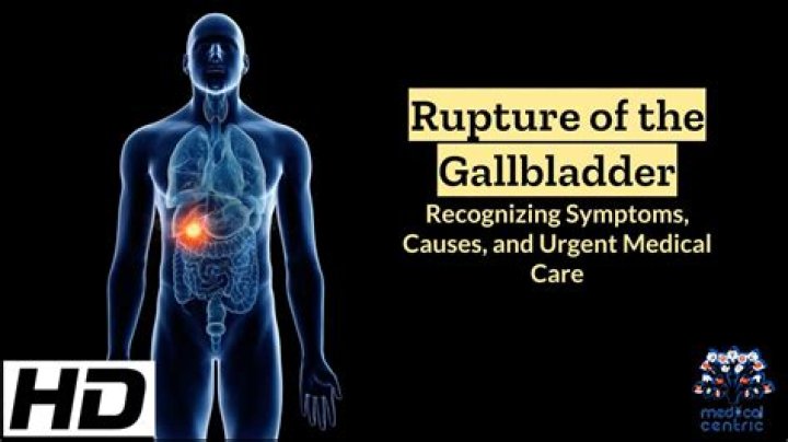 Can gallbladder burst cause death?