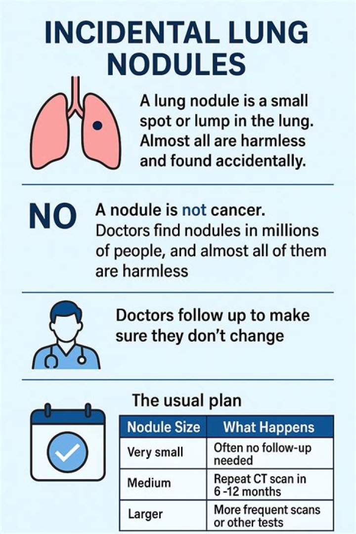 Can GERD cause lung nodules?