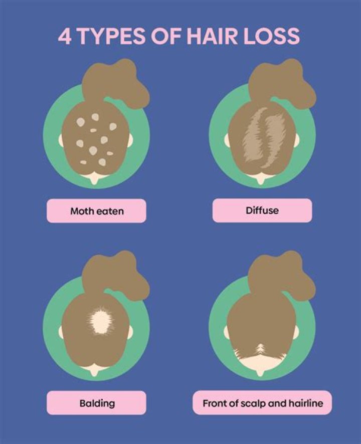 Can hot baths cause hair loss?