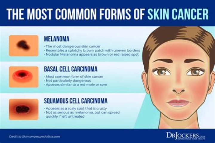 Can LED cause skin damage?