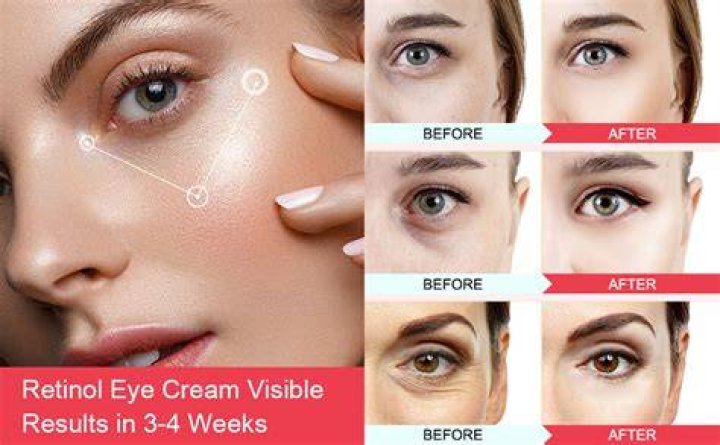 Can retinol reduce dark circles?
