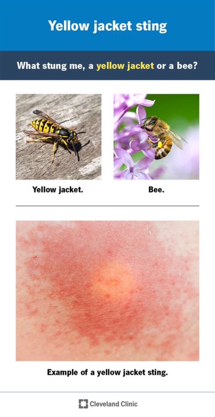 Can yellow jackets sting through clothing?