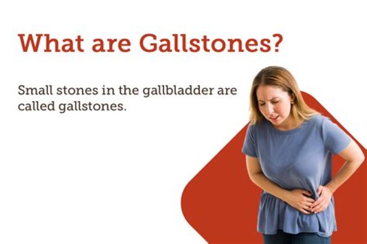 Can you live with gallstones forever?