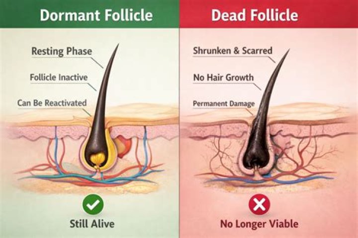 Can you repair dead hair follicles?
