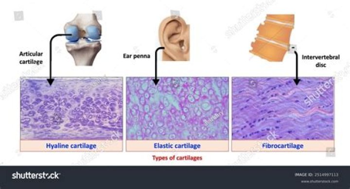 Can you reshape ear cartilage?