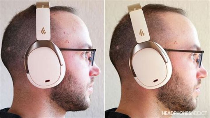 Can you wear headphones after otoplasty?