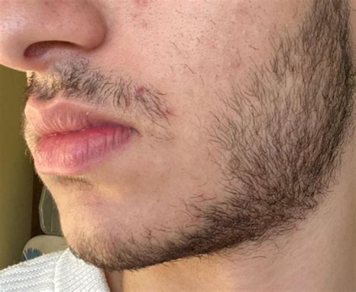 Do First Nations have facial hair?