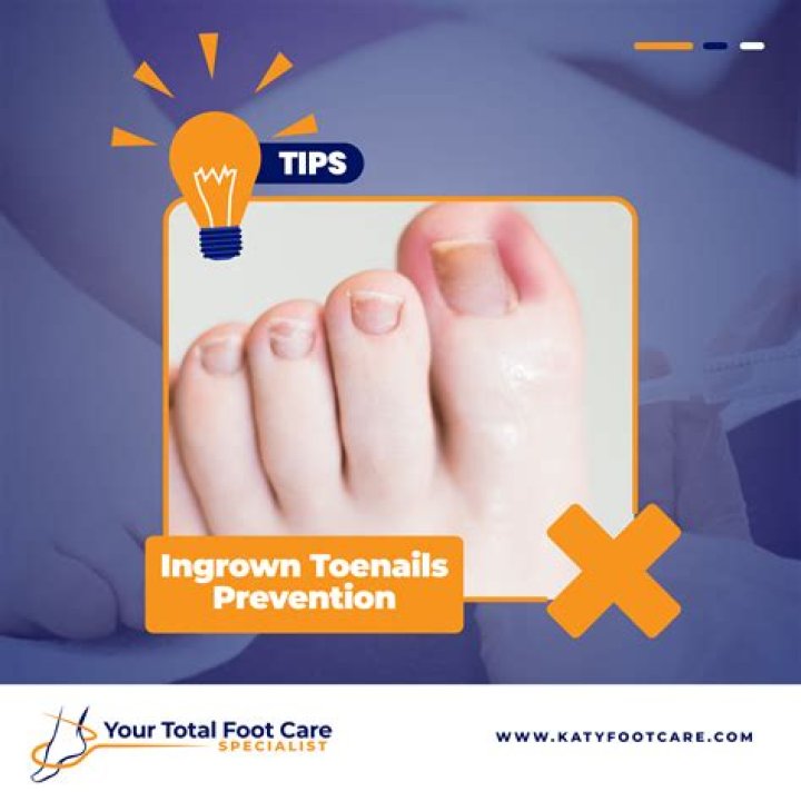 Do ingrown toenails smell?