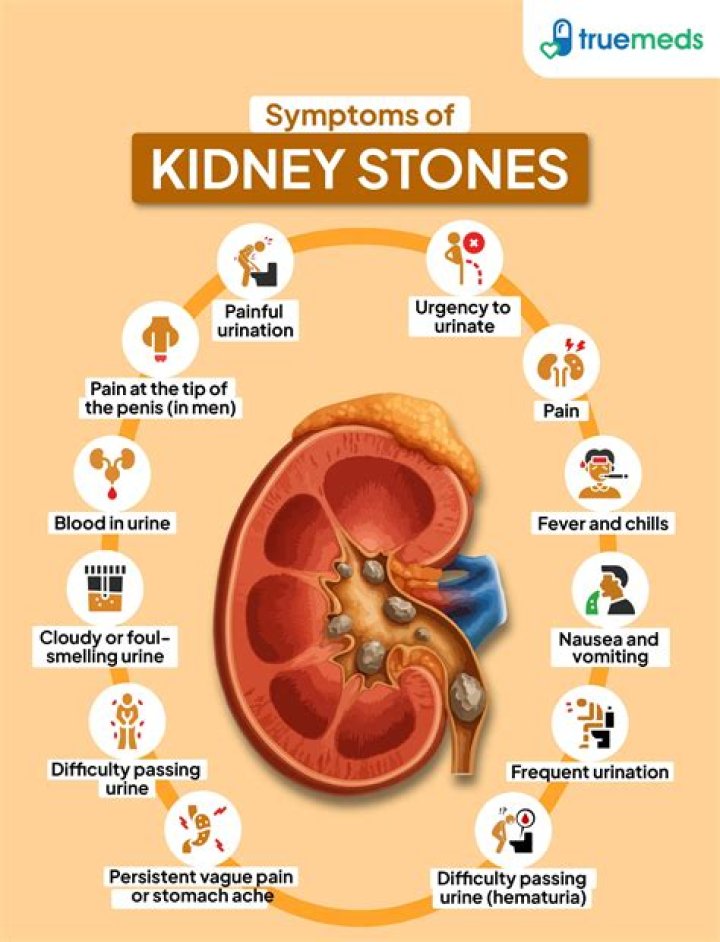 Do kidney stones sink or float?