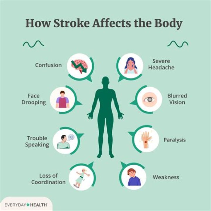 Do stroke victims get worse before better?