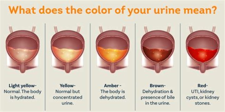 Do you pee more in ketosis?