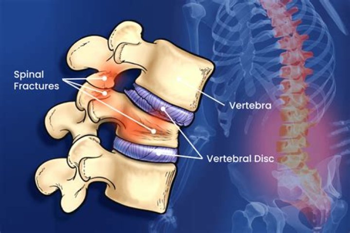 Does fracture Tenrai come back?