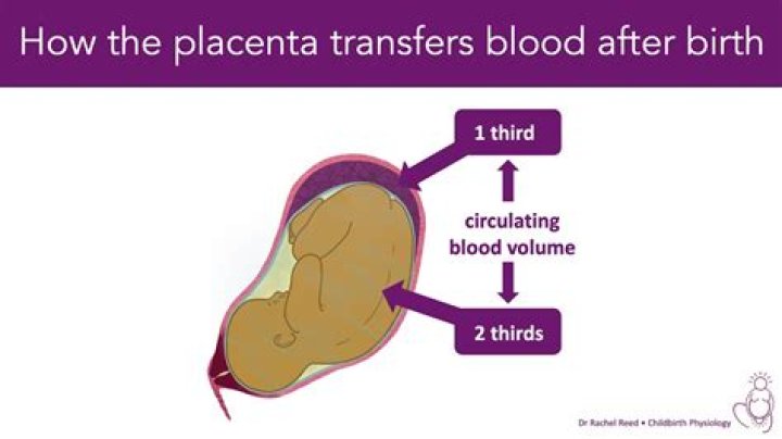 Does giving birth to placenta hurt?