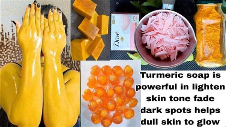 Does turmeric help a fatty liver?