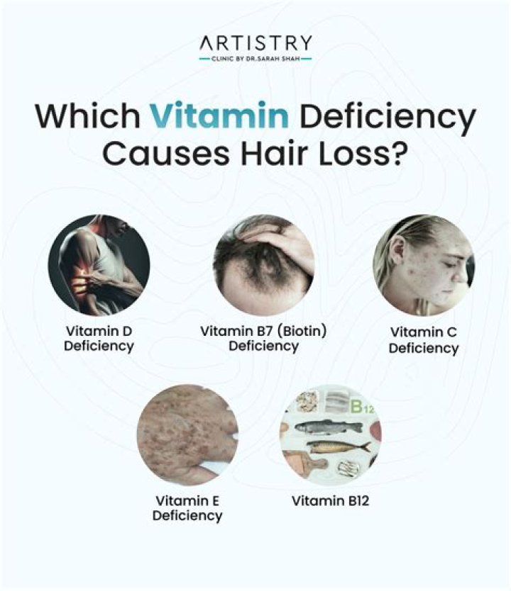 Does vitamin D cause melanoma?