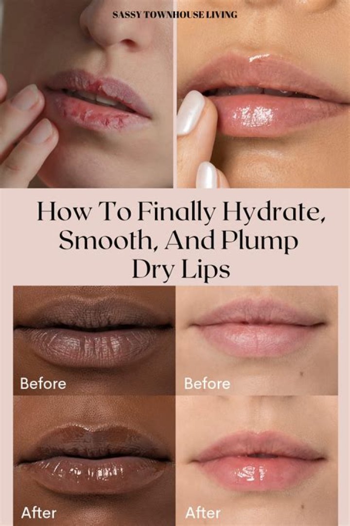 How can I hydrate my lips overnight?