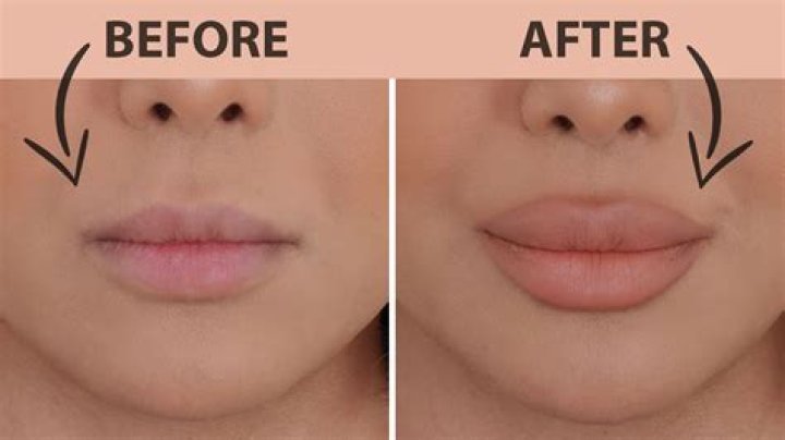 How can I make my mouth kissable?