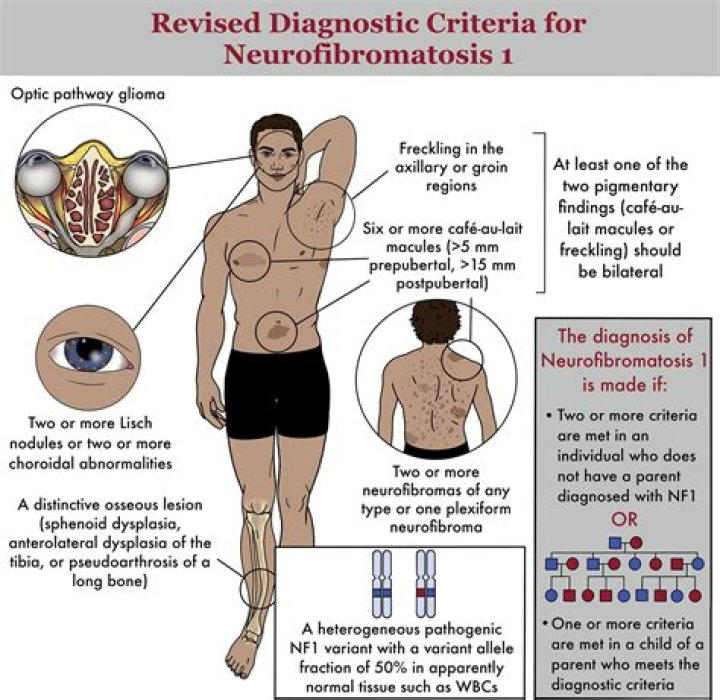 How common are sporadic neurofibromas?