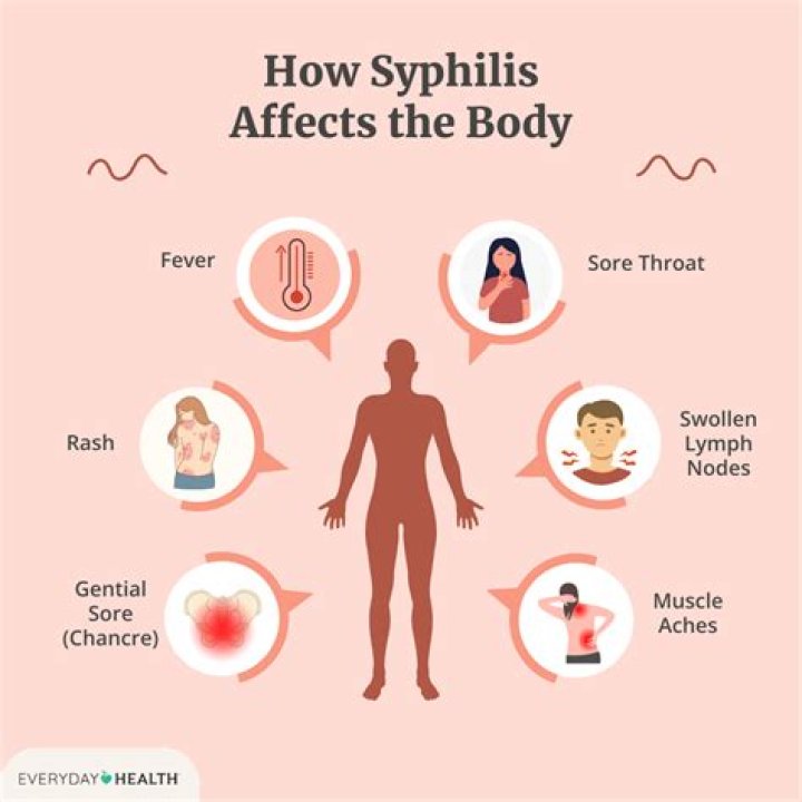 How did Mercury cure syphilis?