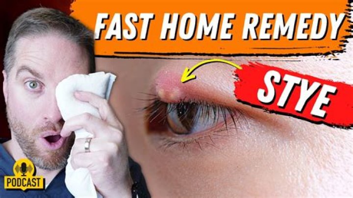 How do I get rid of a cystic pimple overnight?