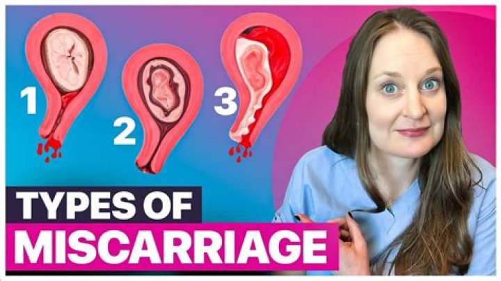 How do I honor my miscarried baby?