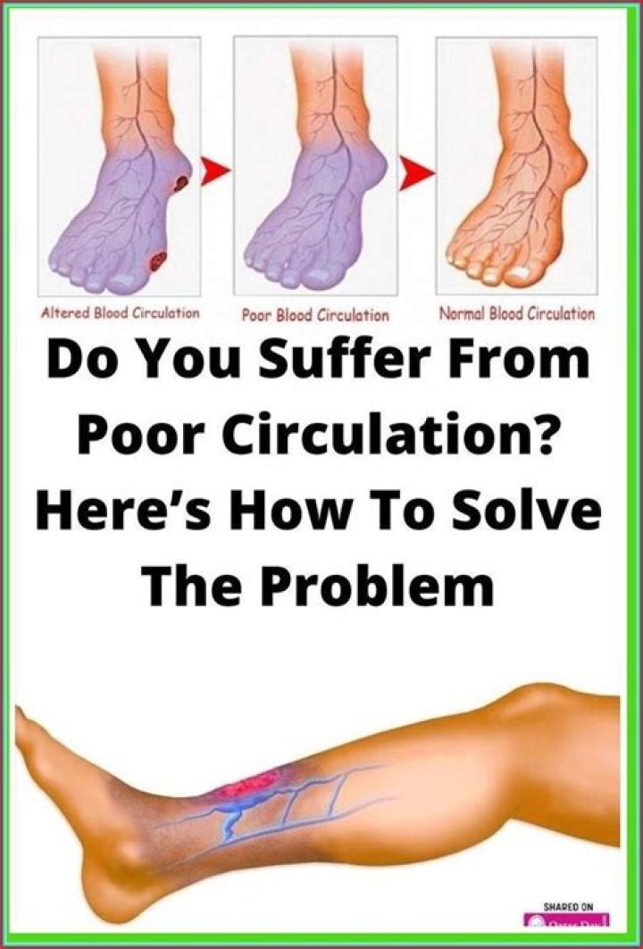 How do I know if I have poor circulation?