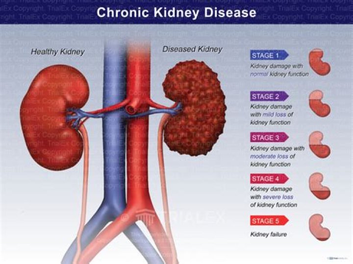 How do I know my kidney is healthy?