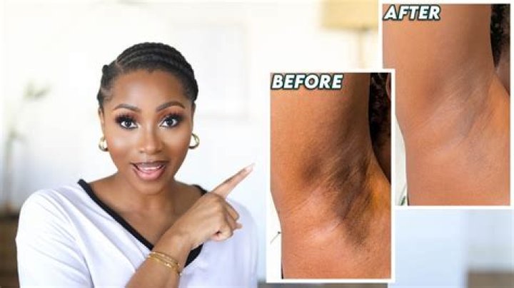 How do you clean your armpits without soap?