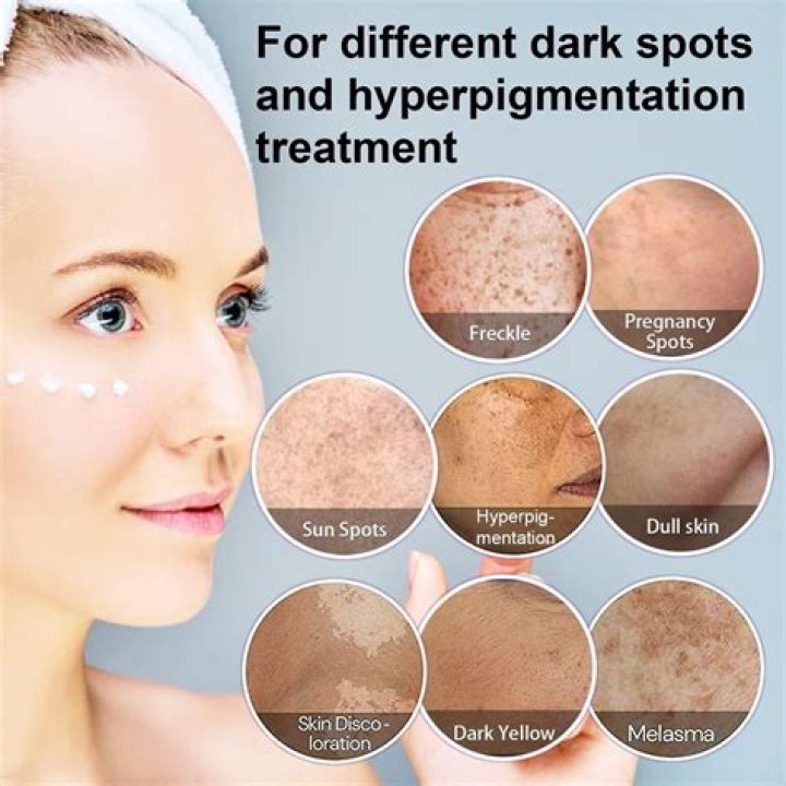 How do you fade dark spots naturally?