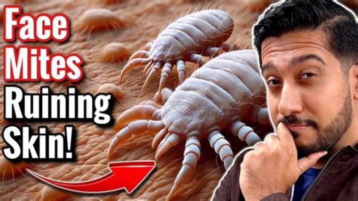 How do you get rid of face mites?