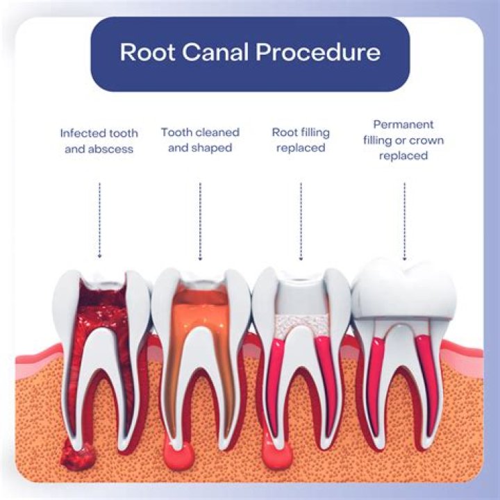 How do you make a root stimulator?