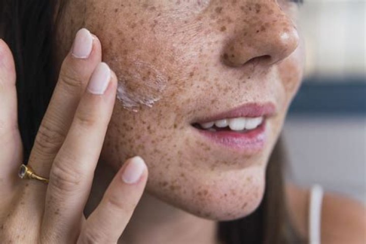 How do you tan if you have freckles?