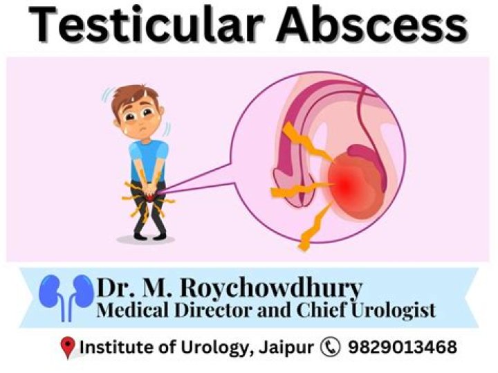 How do you treat a testicular infection naturally?