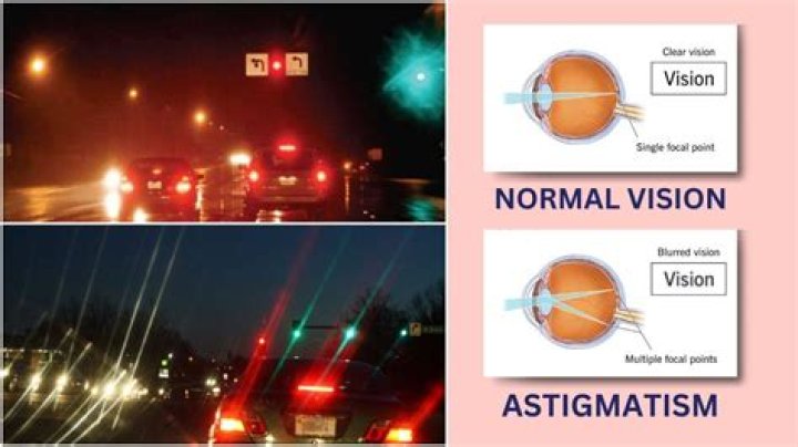 How does someone with astigmatism see lights?
