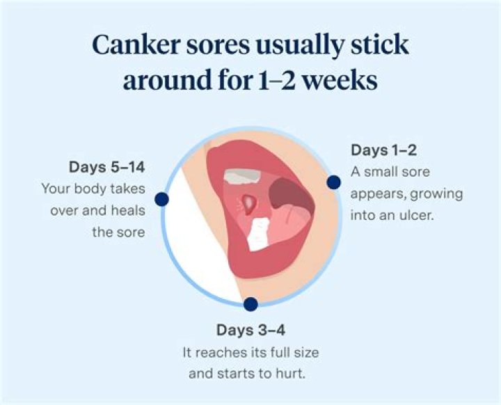 How long do mouth sores last?