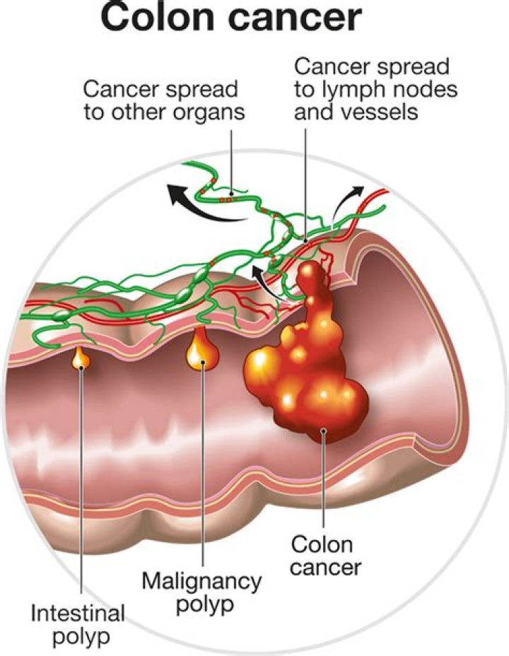 How long does a cancerous mole take to spread?
