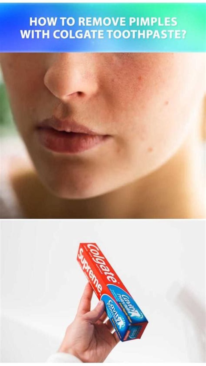 How long leave toothpaste on spots?