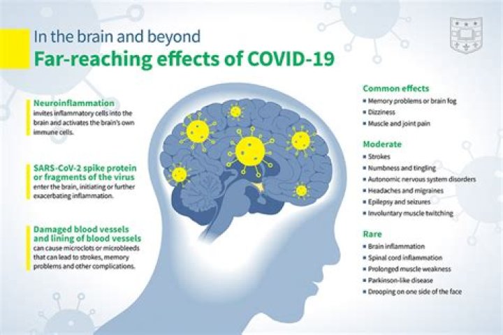 How many TB is your brain?