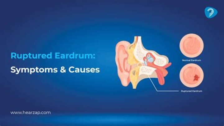 How painful is a ruptured eardrum?