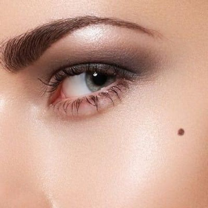 How painful is mole removal?