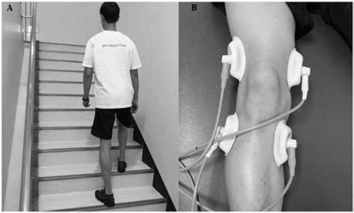 How soon can I climb stairs after knee replacement?