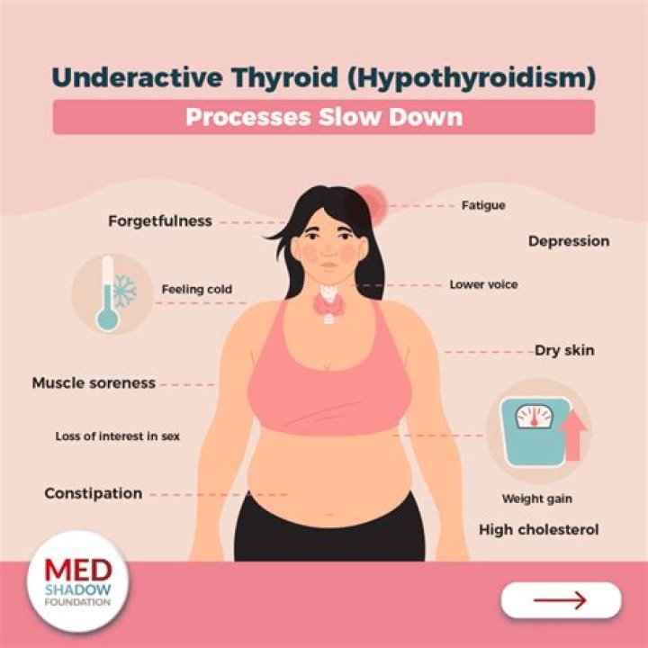 Is cabbage good for hypothyroidism?