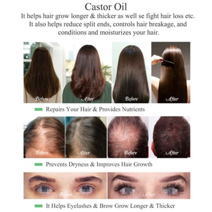 Is castor oil good for all hair types?