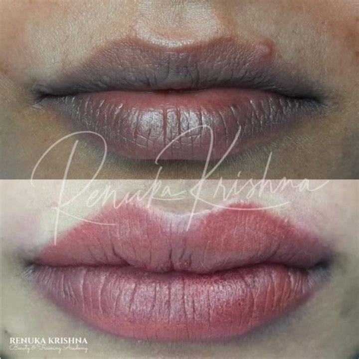 Is lip blush tattoo painful?